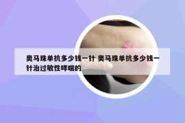 奧馬珠單抗多少錢一針 奧馬珠單抗多少錢一針治過(guò)敏性哮喘的