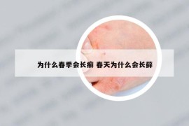 為什么春季會(huì)長癬 春天為什么會(huì)長蘚
