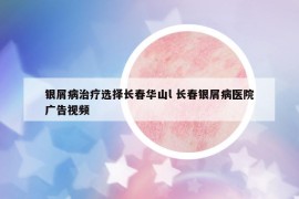 銀屑病治療選擇長(zhǎng)春華山l 長(zhǎng)春銀屑病醫(yī)院廣告視頻