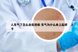 人生氣了怎么會出現(xiàn)癬 生氣為什么身上起疹子