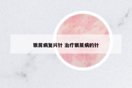 銀屑病復(fù)興針 治療銀屑病的針