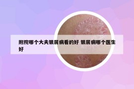 附院哪個大夫銀屑病看的好 銀屑病哪個醫(yī)生好
