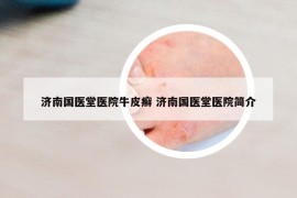 濟南國醫(yī)堂醫(yī)院牛皮癬 濟南國醫(yī)堂醫(yī)院簡介