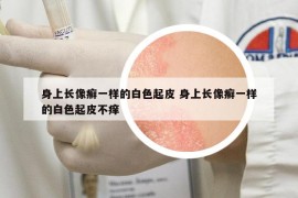 身上長像癬一樣的白色起皮 身上長像癬一樣的白色起皮不癢