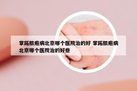 掌跖膿皰病北京哪個醫(yī)院治的好 掌跖膿皰病北京哪個醫(yī)院治的好些