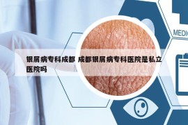 銀屑病?？瞥啥?成都銀屑病?？漆t(yī)院是私立醫(yī)院嗎