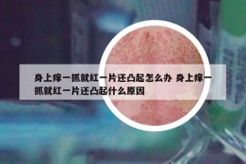 身上癢一抓就紅一片還凸起怎么辦 身上癢一抓就紅一片還凸起什么原因