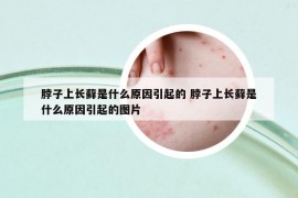 脖子上長蘚是什么原因引起的 脖子上長蘚是什么原因引起的圖片