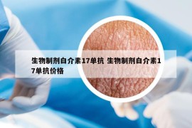 生物制劑白介素17單抗 生物制劑白介素17單抗價(jià)格