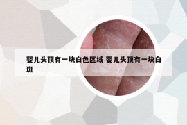 嬰兒頭頂有一塊白色區(qū)域 嬰兒頭頂有一塊白斑