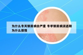 為什么冬天銀屑病會(huì)嚴(yán)重 冬季銀屑病消退期為什么很慢