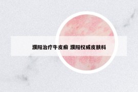 濮陽治療牛皮癬 濮陽權(quán)威皮膚科