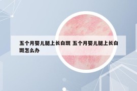 五個月嬰兒腿上長白斑 五個月嬰兒腿上長白斑怎么辦