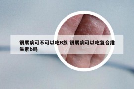 銀屑病可不可以吃B族 銀屑病可以吃復(fù)合維生素b嗎