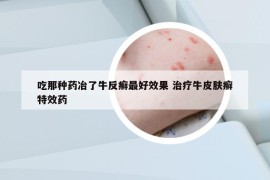 吃那種藥冶了牛反癬最好效果 治療牛皮膚癬特效藥