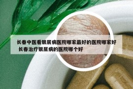 長春中醫(yī)看銀屑病醫(yī)院哪家最好的醫(yī)院哪家好 長春治療銀屑病的醫(yī)院哪個好