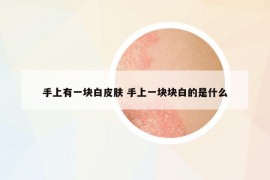 手上有一塊白皮膚 手上一塊塊白的是什么
