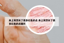 身上突然長了很多紅色的點 身上突然長了很多紅色的點圖片
