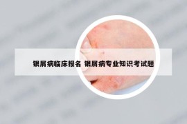 銀屑病臨床報(bào)名 銀屑病專業(yè)知識(shí)考試題