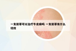 一支箭草可以治療牛皮癬嗎 一支箭草有什么功效