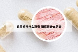 銀屑癬用什么藥膏 銀屑擦什么藥膏