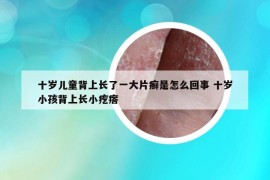 十歲兒童背上長了一大片癬是怎么回事 十歲小孩背上長小疙瘩