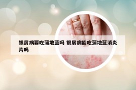 銀屑病要吃蒲地藍(lán)嗎 銀屑病能吃蒲地藍(lán)消炎片嗎
