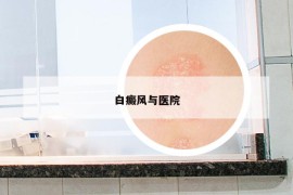 白癜風(fēng)與醫(yī)院