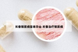 長(zhǎng)春銀屑病皆來(lái)華山 長(zhǎng)春治療銀屑病
