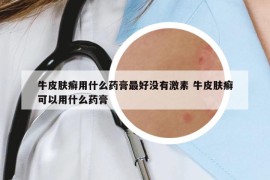 牛皮膚癬用什么藥膏最好沒有激素 牛皮膚癬可以用什么藥膏