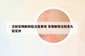 注射生物制劑后注意事項(xiàng) 生物制劑注射多久后見(jiàn)效