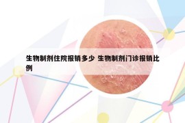 生物制劑住院報銷多少 生物制劑門診報銷比例