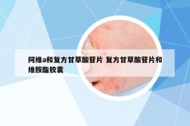 阿維a和復(fù)方甘草酸苷片 復(fù)方甘草酸苷片和維胺酯膠囊