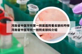 河南省中醫(yī)學(xué)院第一附屬醫(yī)院看皮膚科咋樣 河南省中醫(yī)學(xué)院一附院皮膚科介紹