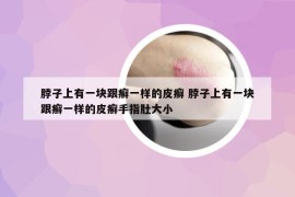 脖子上有一塊跟癬一樣的皮癬 脖子上有一塊跟癬一樣的皮癬手指肚大小
