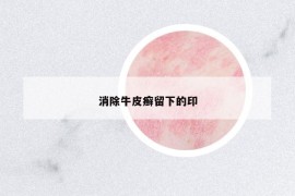消除牛皮癬留下的印