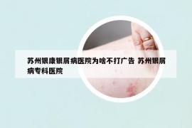 蘇州銀康銀屑病醫(yī)院為啥不打廣告 蘇州銀屑病?？漆t(yī)院