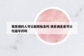 銀屑病的人可以服用胎盤嗎 銀屑病患者可以吃避孕藥嗎