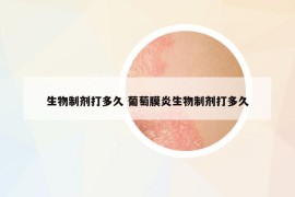 生物制劑打多久 葡萄膜炎生物制劑打多久