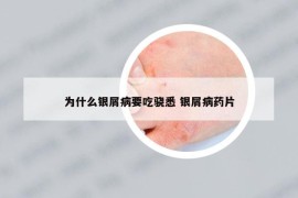 為什么銀屑病要吃驍悉 銀屑病藥片