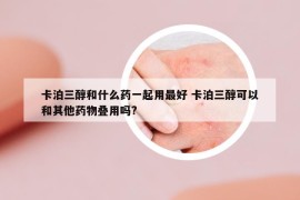 卡泊三醇和什么藥一起用最好 卡泊三醇可以和其他藥物疊用嗎?