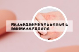 阿達(dá)木單抗生物制劑副作用會自動消失嗎 生物制劑阿達(dá)木單抗是最好的嘛