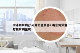 菏澤銀屑病go問(wèn)濰坊孟晨星a 山東菏澤治療銀屑病醫(yī)院