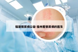 福建銀屑病公益 福州看銀屑病的醫(yī)生