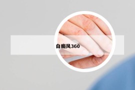 白癜風360