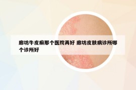 廊坊牛皮癬那個醫(yī)院再好 廊坊皮膚病診所哪個診所好