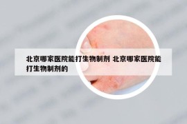 北京哪家醫(yī)院能打生物制劑 北京哪家醫(yī)院能打生物制劑的