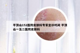 平頂山152醫(yī)院皮膚科專家坐診時(shí)間 平頂山一五二醫(yī)院皮膚科