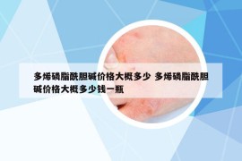 多烯磷脂酰膽堿價格大概多少 多烯磷脂酰膽堿價格大概多少錢一瓶