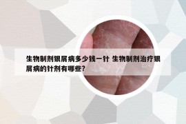 生物制劑銀屑病多少錢一針 生物制劑治療銀屑病的針劑有哪些?
